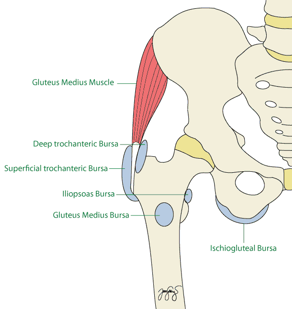 bursa hip mri